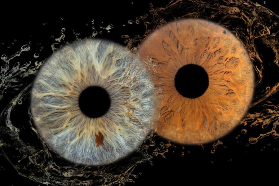 IRIS Photography (macro photo of your eye) - What you get for $68: the included digital photo and what it means